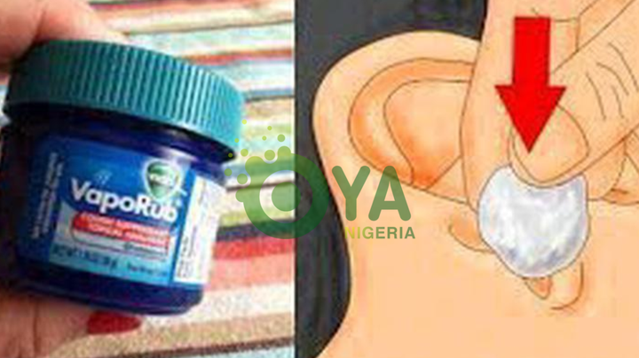 JUST IN: If you put a cotton bud with VapoRub in your ear all night, here is the surprising effect JUST IN: If you put a cotton bud with VapoRub in your ear all night, here is the surprising effect