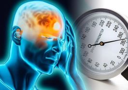 If Your Headache Is from Hypertension: Doctor’s Tips to Prevent Hypertension-Related Headaches