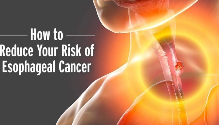 ‘First’ Symptom Of Oesophageal Cancer – And How To Reduce Your Risk (BREAKING)