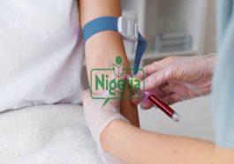 Six Important Medical Tests You Should Do Before Getting Married