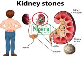 Foods You Should Stop Eating To Prevent Kidney Problems