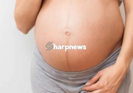 Reason Why Black Line Appear Along The Stomach of Pregnant Woman And It’s Function