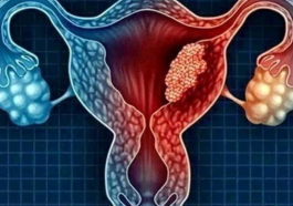 Uterine Cancer: Stay Away From These 4 (Four) Things To Avoid The Risk Of Being A Victim