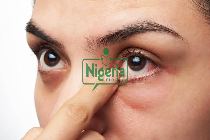Ignore Following Eye Symptoms And You Could Go Blind From Diabetes