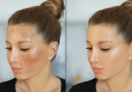 When Your Face Has Dark Spots, Use Following For Smooth Spotless Skin