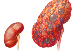 Eight Warning Signs of Kidney Damage You Should Never Ignore – Doctors Reveal What to Watch For