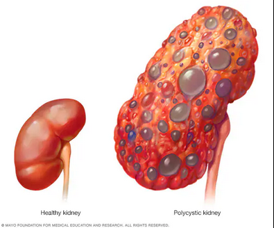 Eight Warning Signs of Kidney Damage You Should Never Ignore – Doctors Reveal What to Watch For Eight Warning Signs of Kidney Damage You Should Never Ignore – Doctors Reveal What to Watch For