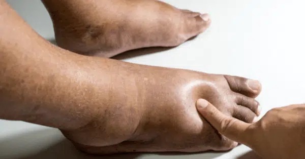 Seven warning signs your heart might not be well (and 7 symptoms of heart problems) Seven warning signs your heart might not be well (and 7 symptoms of heart problems)