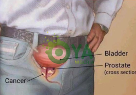 5 Early Warning Signs Of An Enlarged Prostate That Every Man Need To Know