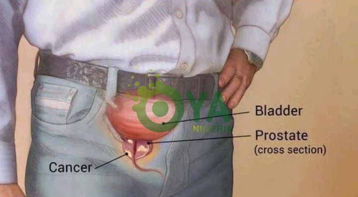 5 Early Warning Signs Of An Enlarged Prostate That Every Man Need To Know 5 Early Warning Signs Of An Enlarged Prostate That Every Man Need To Know
