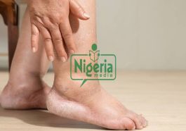 JUST IN: Alarming Ways Foot Pain Signals Health Issues