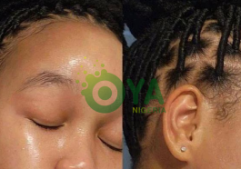 JUST IN: Easiest ways to get a youthful face and get rid of wrinkles