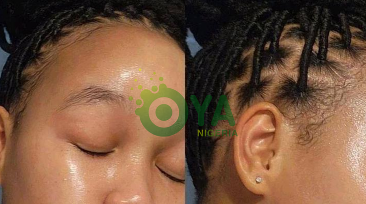 JUST IN: Easiest ways to get a youthful face and get rid of wrinkles JUST IN: Easiest ways to get a youthful face and get rid of wrinkles