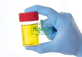 Following Home Based HIV Testing Using Urine
