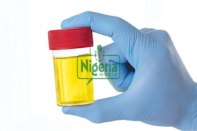 Following Home Based HIV Testing Using Urine