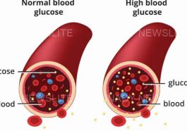 Diabetes is very dangerous avoid excessive intake of these 4 substances in order to stay healthy