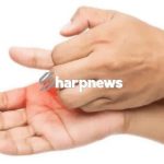 5 list of Health Meaning Of Itching Palms