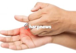 5 list of Health Meaning Of Itching Palms