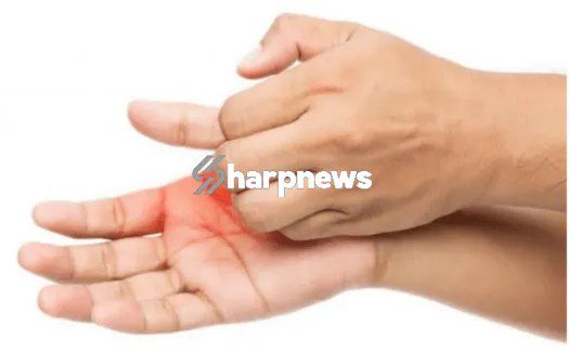 5 list of Health Meaning Of Itching Palms