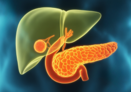 Type Two diabetes may increase risk of advanced cancer