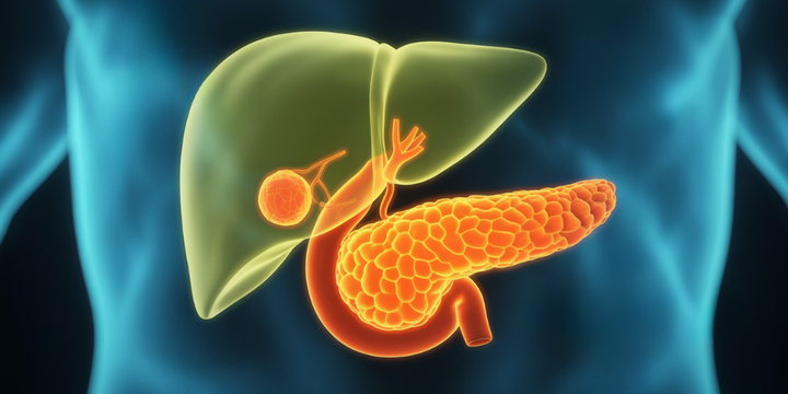 Type Two diabetes may increase risk of advanced cancer Type Two diabetes may increase risk of advanced cancer