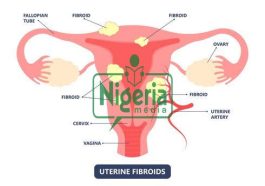 Ten Common Uterine Diseases Every Woman Should Know