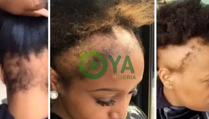 BREAKING: African Women Please Stop Doing These To Your Head(Opinion)