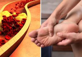The ‘Silent’ Symptom Of Dangerously High Cholesterol That Shows On Your TOES – And 3 Other Signs