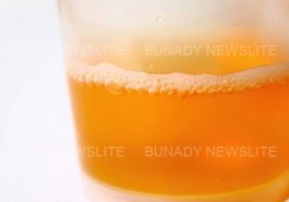 Foamy Urine: If Your Urine Always Foams, Here Are It’s 5 Possible Causes And Foods To Watch Out For