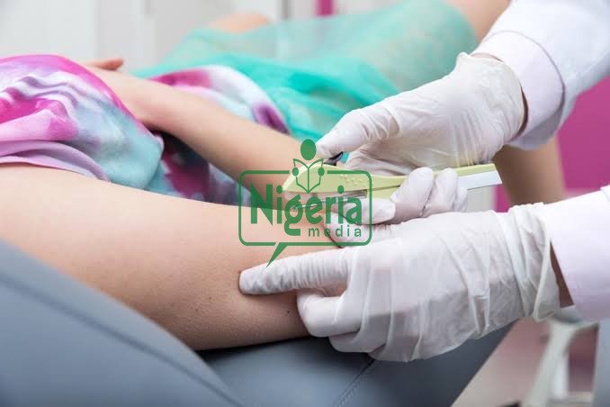 Side Effects Of Contraceptive Implants That You Need To Know