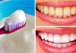 Natural Following Home Remedies To Get Rid Of Yellow Teeth