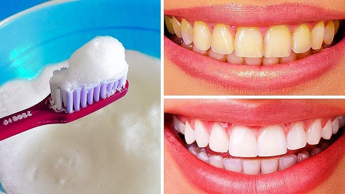 Natural Following Home Remedies To Get Rid Of Yellow Teeth