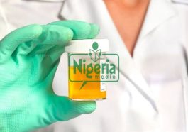 If Your Urine Always Foams, Here Are It’s 5 (Five) Possible Causes And Foods To Watch Out For