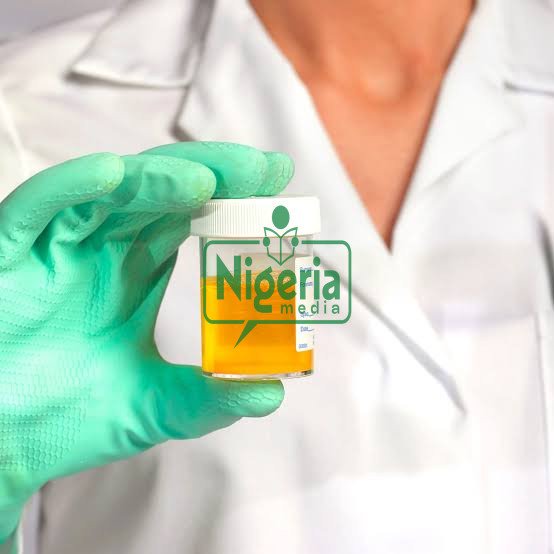 If Your Urine Always Foams, Here Are It’s 5 (Five) Possible Causes And Foods To Watch Out For